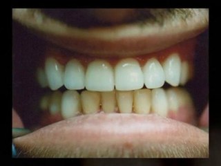 Find a Dentist in Woodland Hills CA