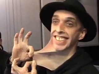 L'uomo con la pelle di gomma