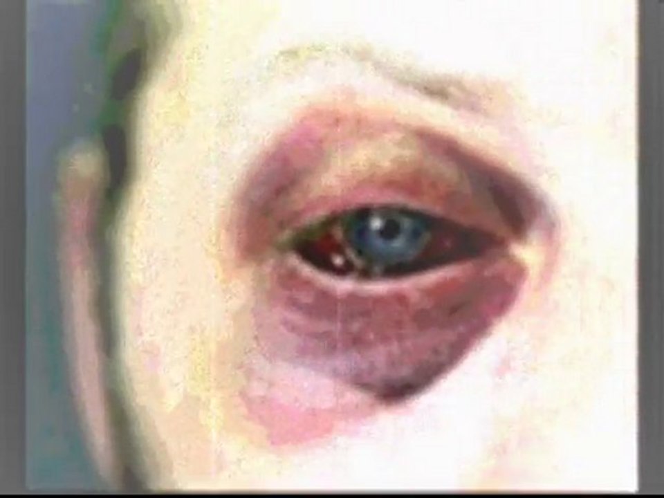 El Granato - Red Eye [Dubstep]