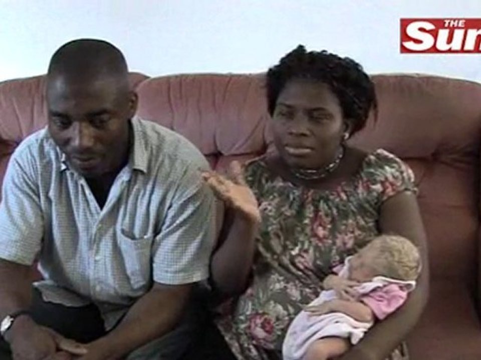 White Baby Born to Black Parents