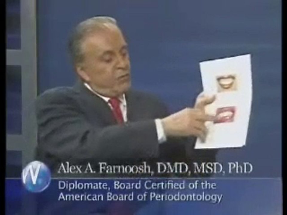 Los Angeles Dentist Discussing Gummy Smile