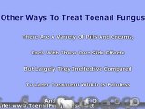 Laser Treatment For Toenail Fungus