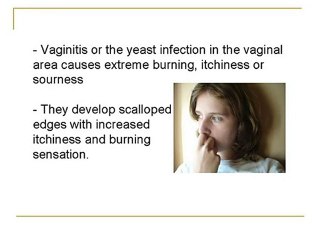 Healthy Living Helps Cure Yeast Infections