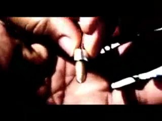 Nonpoint Alive and Kicking