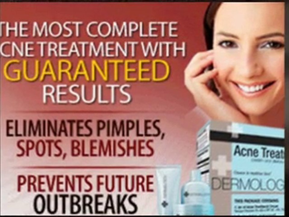 Dermology Acne Cream - Get Rid of Pizza Face!