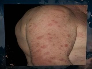 Black Mold Removal Burleith Washington DC