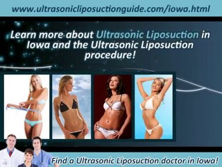 Ultrasonic Liposuction Iowa