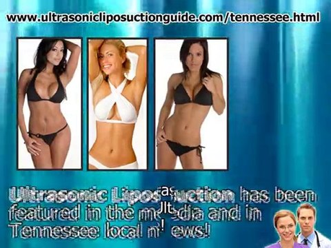 Find a Ultrasonic Liposuction doctor in Tennessee.