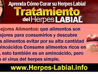 Download Video: Como Curar Herpes Labial - Tratamiento del Herpes Labial