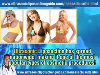 Ultrasonic Liposuction Massachusetts