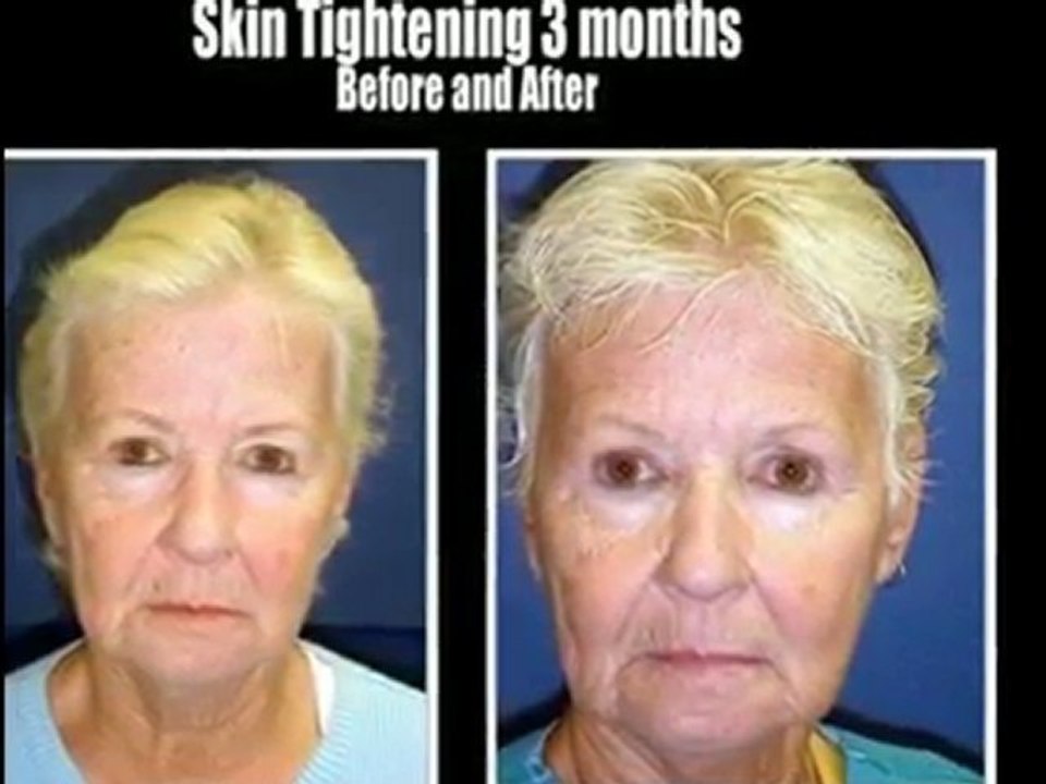 Board Certified Plastic Surgeon Florida Michael Stampar DO