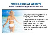 Cosmetic or Plastic Surgery Scar in Tucson AZ