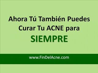 Tratamiento Natural Para el ACNE