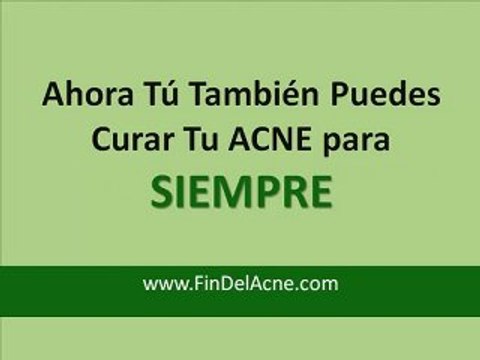El ACNE Tratamientos Para Eliminarlo Para Siempre