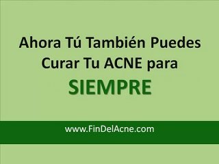 ¿Hay Cura Para Acne? Entra Aquí!
