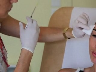 Traitement des rides de la patte d'oie par toxine Botolique