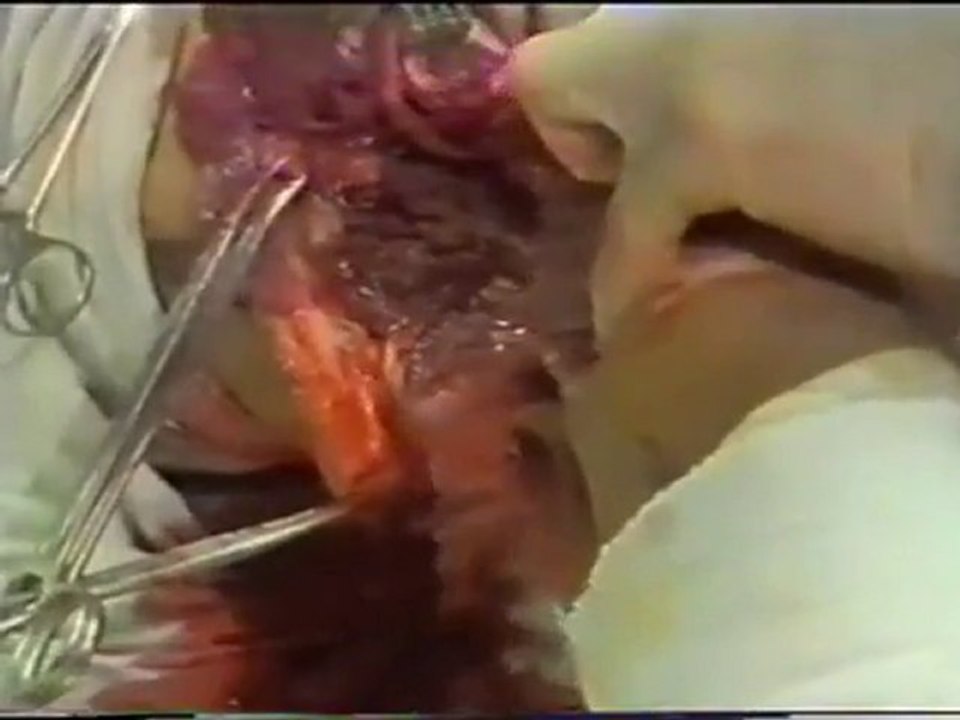 War_Surgery_Part_3