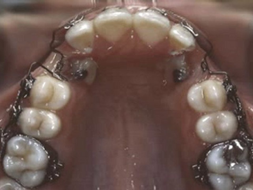 Gömük kaninlerin sürdürülmesi