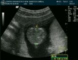 Ecografia Mayo 2010