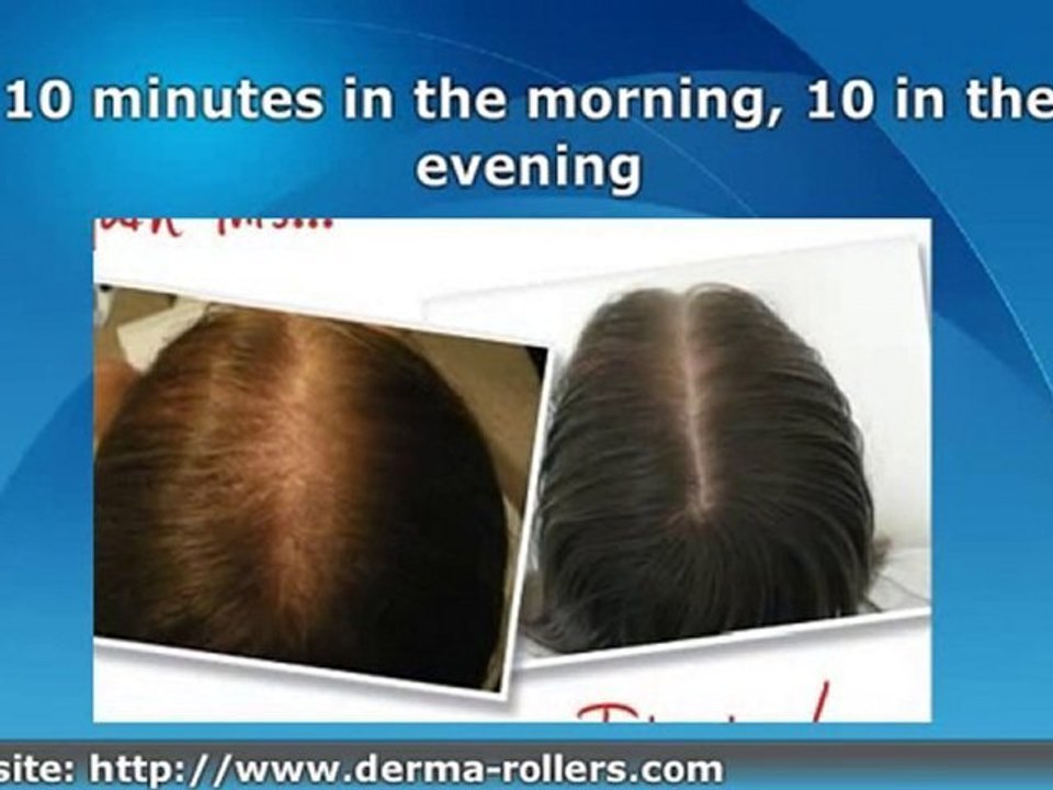 Scientia Hair Laser Guarantee