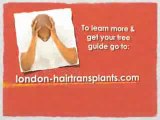 London Hair Transplants - free videos & guides. Hair loss,