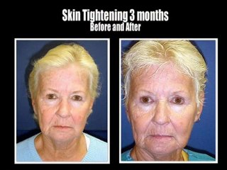 Sarasota day spa Spago Day Spa Florida facelift Dr. Stampar