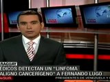 Médicos detectan un linfoma maligno cancerígeno a Fernando