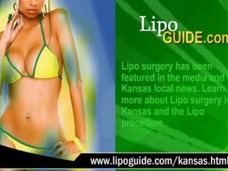 Lipo Kansas: Find Local Surgeons 🏥