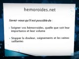 Hemoroides : comment se débarrasser des hémorroïdes