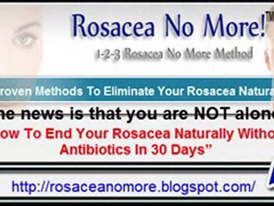 Rosacea Natural Treatment How To Banish Your Rosacea Natural