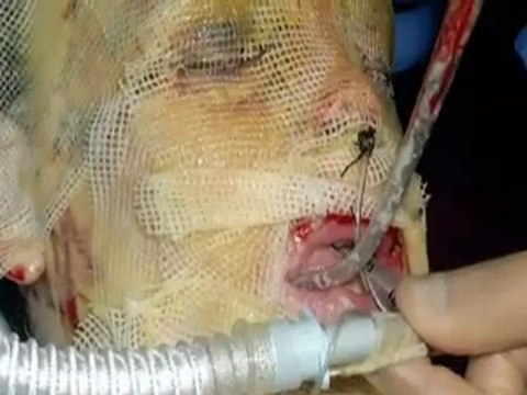 Inspirational Documentary Katie Piper My Beautiful Face