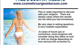 Plastic or Cosmetic Surgery and Risk, Tucson AZ