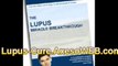Is There a Cure For Lupus? The Cure Lupus With this Info %