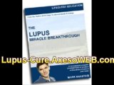 Lupus Disease, Lupus Treatment Best News Lupus Symptoms Cure