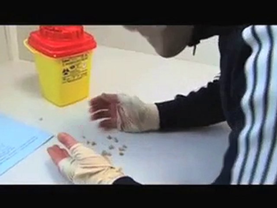 Teaser Patrice LE MÉHAUTÉ