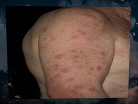 Black Mold Removal Black Point FL 386