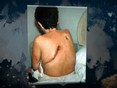 Asbestos Removal North De Land FL 386