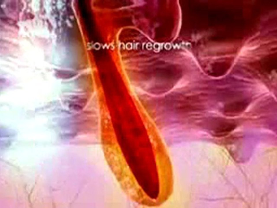 Nono 8800 Cheap Painliness Long-term hair removal