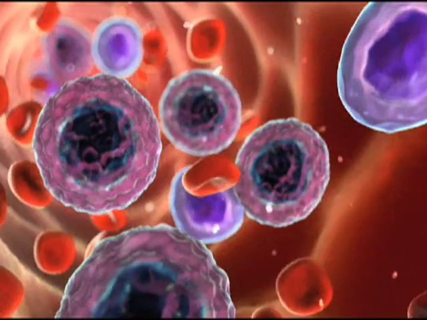 Living with chronic myeloid leukemia