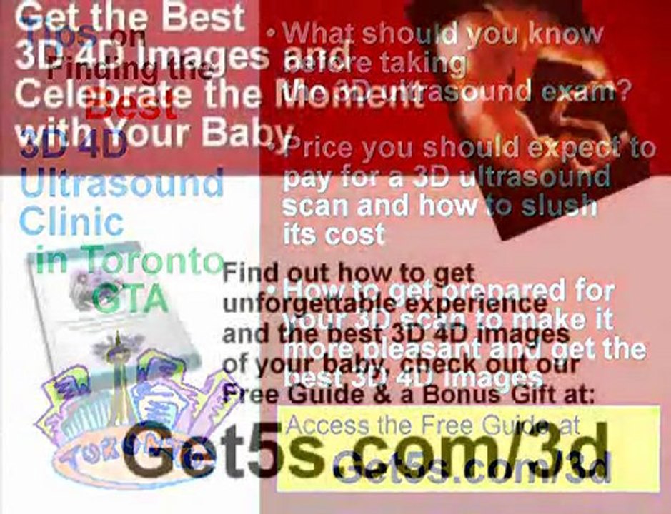 Toronto 3D ultrasound and how to find 3D ultrasound in Toro