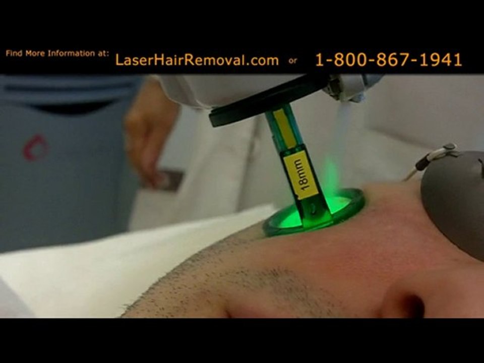 Laser Hair Removal Face (LaserHairRemoval.com)