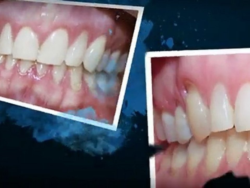 Greeley Orthodontics - Super Smiles By Doctor K