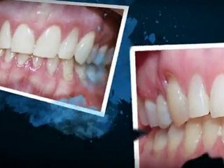 Greeley Orthodontics - Super Smiles By Doctor K