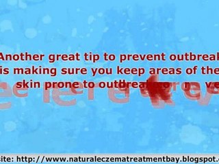 A Parent Guide to Getting Rid Of Baby Eczema in 7 days