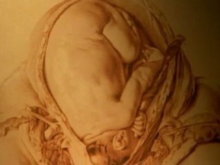 Robert Winston explains a perfect 18th century operation