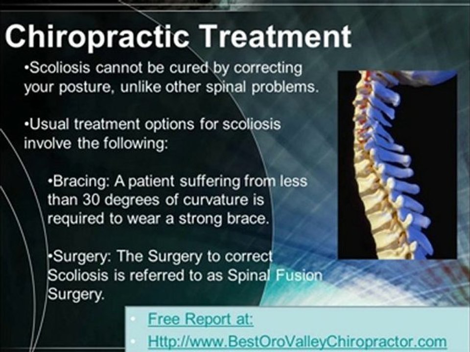 How an Oro Valley Chiropractor can care for Scoliosis