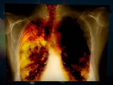 Asbestos Removal Escondido CA 92026