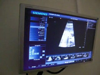 mon coeur bat déjà beaucoup