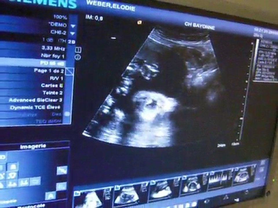 mon nez et ma bouche