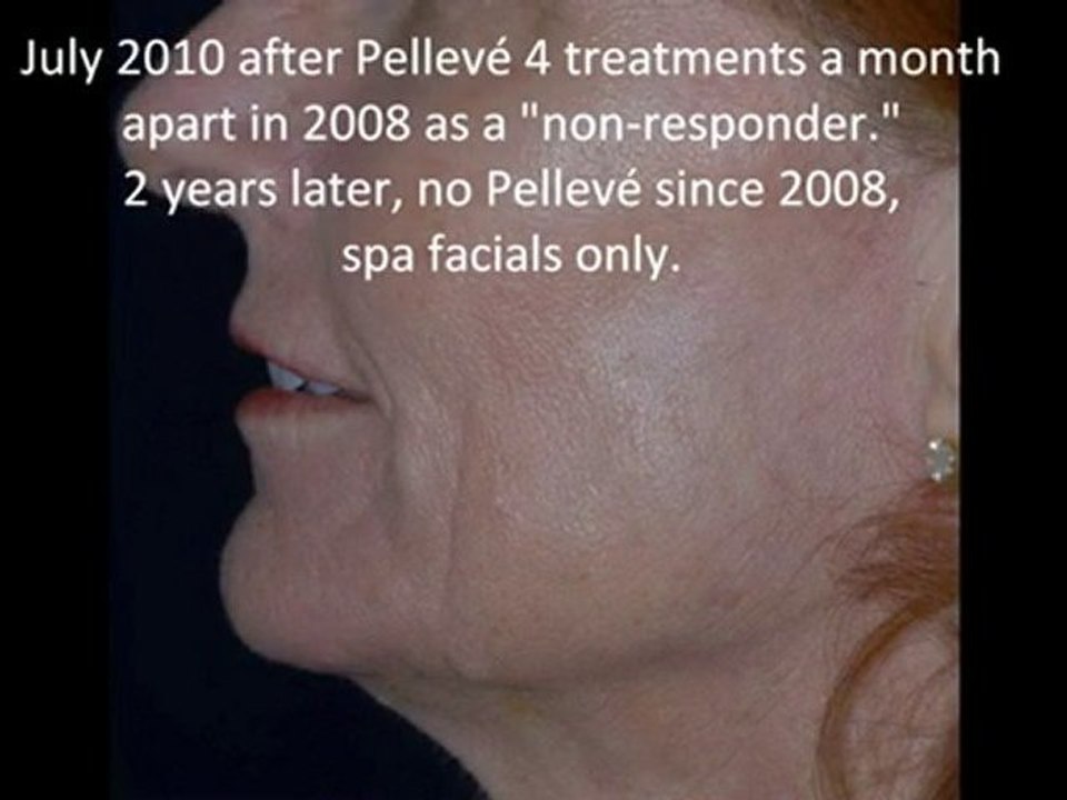 Pelleve in Punta Gorda with Dr. Michael Stampar